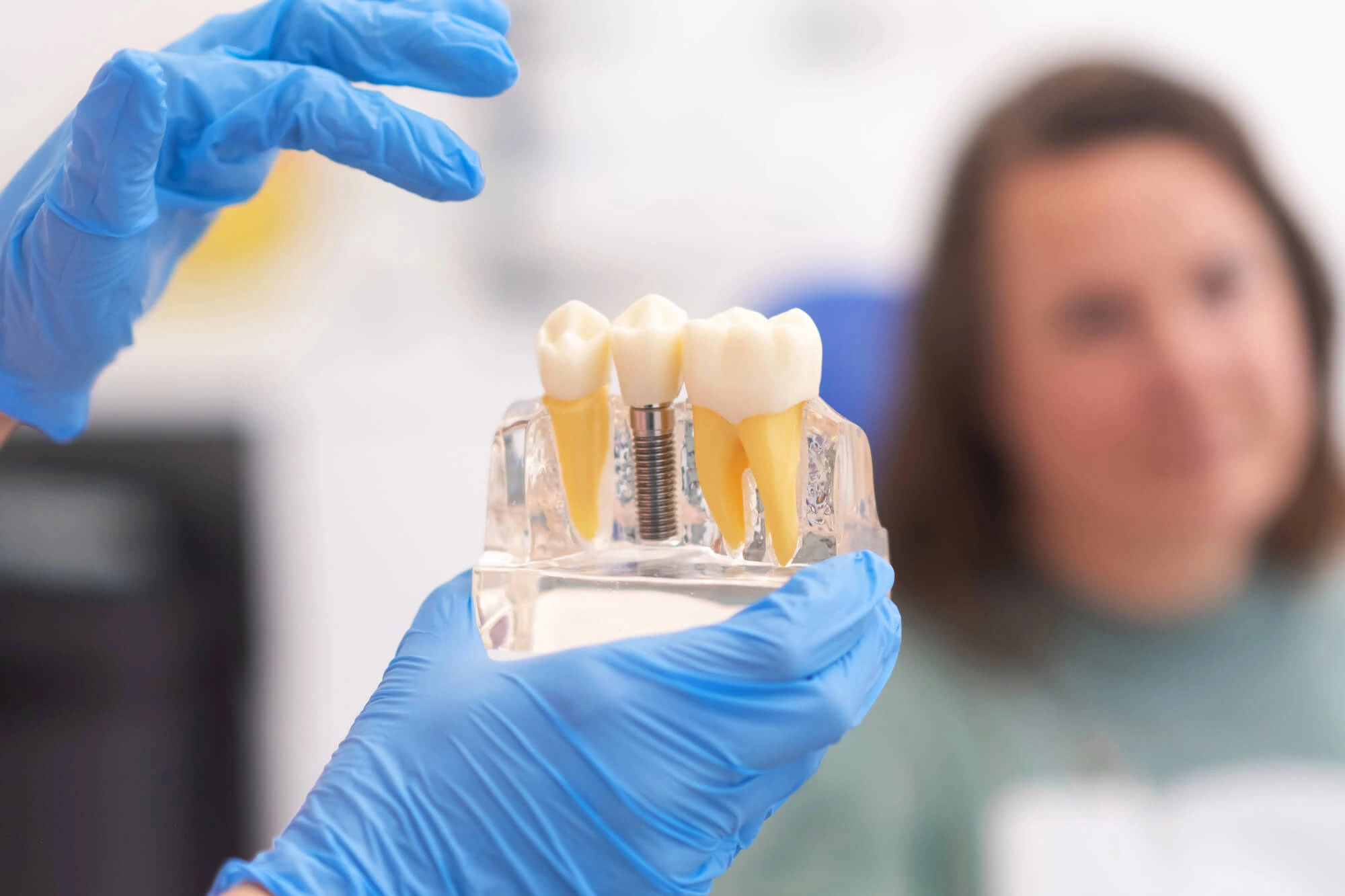 Dental-Implants-Clawson-MI 